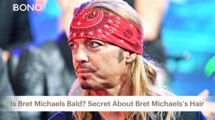 Why is Bret Michaels always bald?